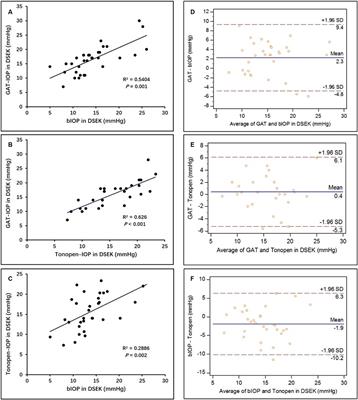 Intraocular pressure measurement and association with corneal biomechanics in patients underwent Descemet’s stripping with endothelial keratoplasty: a comparative study